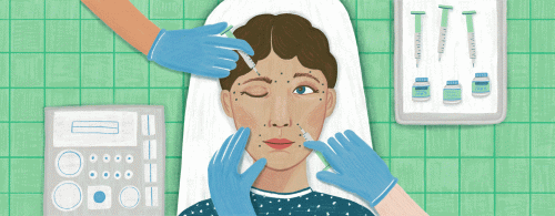 botox.gif